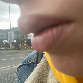 Tuğçe Aktaş Beauty Center Dudak Dolgusu Şikayetim