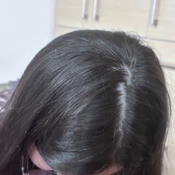 Sebamed Kepeğe Karşı Etkili Şampuan Kepek Yaptı