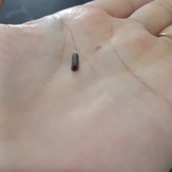 A101 Dorbi Puding İçinden Plastik Çıkması