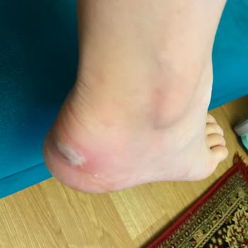 Occasion Yeni Ayakkabının Vurması