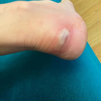 Occasion Yeni Ayakkabının Vurması