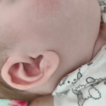 Mustela Cilt Alerjisi Yaptı!