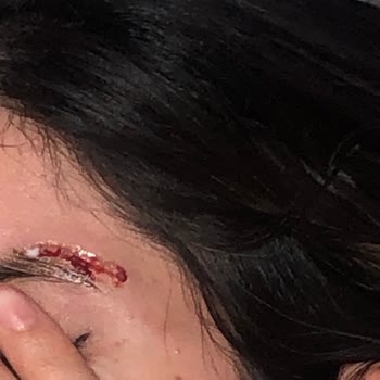 Art Estetik & Güzellik Merkezi Art Estetik Kalıcı İz Bıraktı