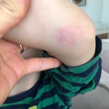 BİM Bursa Ertuğrul, Ürün Bandına Çocuğumun Kolu Sıkıştı