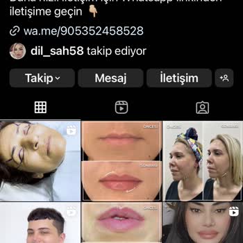 Beylikdüzü Estetik Ve Güzellik Şakak Orta Yüz Ameliyatı Memnuniyetsizliği!