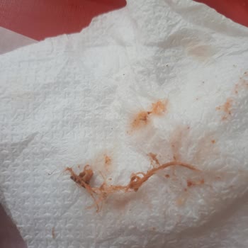 Sr Döner'den Aldığım Dürümde Tavuk Derisi Ve Tüyleri Çıktı