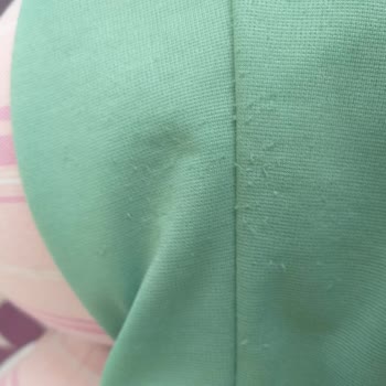 Alvina Ürün Tüylenme Şikayet