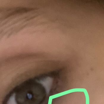 Dermoskin C Vitamini Krem Göz Çevremi Yaktı