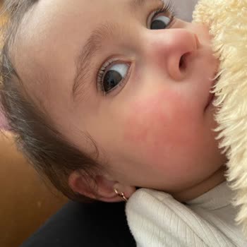 Dr. Öz Klinik Macunu Alerji Yaptı