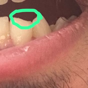 Dürümle Alanya Şubesi'nden Verdiğim Sipariş İçinden Taş Çıkması