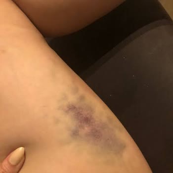 712 Beauty (Tunalı) İşlemden Sonuç Alamama Ve Para İadesi Yapılmaması