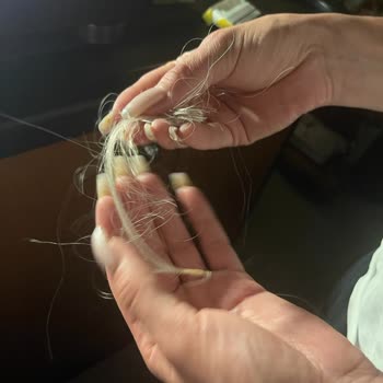 Sedat Biga Hair Studio Saç Kaynak İşlemi Sonrası Dökülmeler