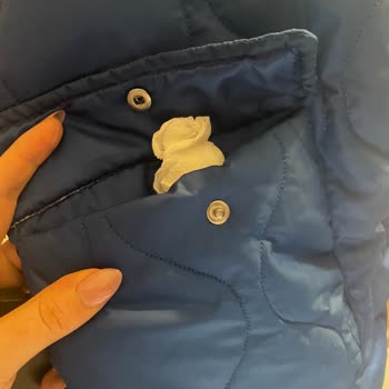 Trendyol Yırtık Kokulu Kullanılmış Ürün Gönderdi