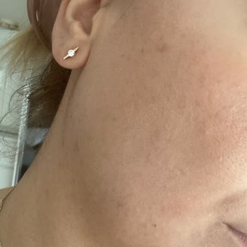 İzmir Nüans Güzellik Merkezi Fazla Ücret Alıyor