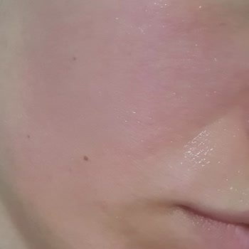Neutrogena Canlandırıcı Peeling Jel Yüzde Alerji Yanma Yaptı