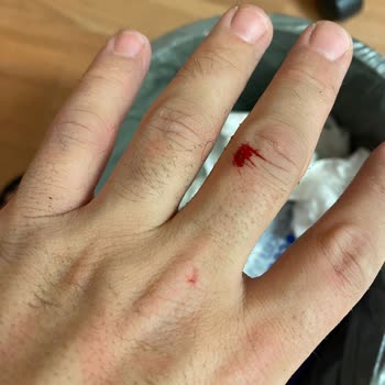 Tüy Silgisi (Kristal Epilatör) Tarafından Yanıltıldım