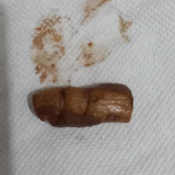 Eti Canga Nin İçinden Çıkan Cisim