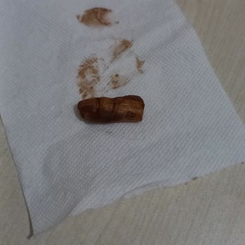 Eti Canga Nin İçinden Çıkan Cisim