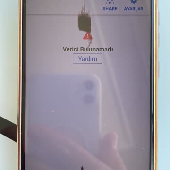 Dexcom Med Salus Aldığım Dexom G6 Şeker Ölçüm Cihazı Arıza Sorunu