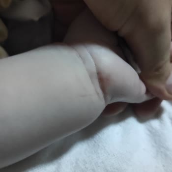 Kanuni Sultan Süleyman Eğitim Araştırma Hastanesi Sağlık Çalışanının Dikkatsiz Davranılması