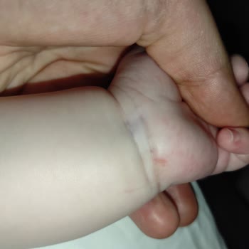 Kanuni Sultan Süleyman Eğitim Araştırma Hastanesi Sağlık Çalışanının Dikkatsiz Davranılması