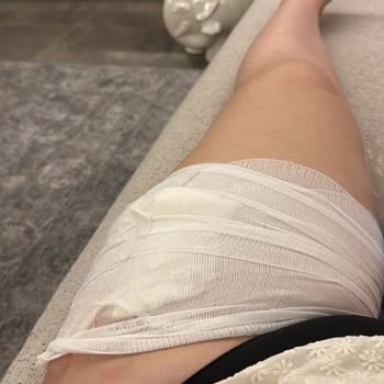 Filo D'olio Müşteriyi Çayla Yakıp Özür Dileme Zahmetinde Bile Bulunmuyor