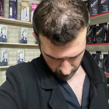 Estecenter İnsanlara Sadece Para Gözüyle Bakan Firma