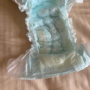 Prima Aktif Bebek Bezi Çiş Sızdırıyor