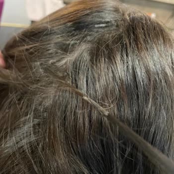 Ali Gür Selamiçeşme Saç Kaynak İşlemi Deneyimim