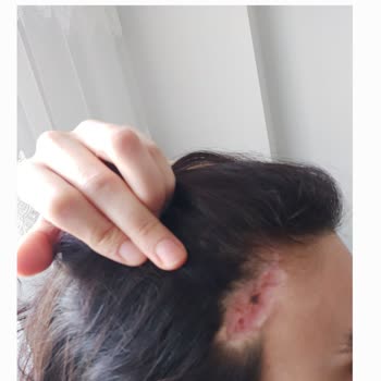 Op. Dr. Hüsrev Çetin Estetik İşlem Sonuçları