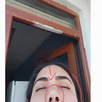 Op. Dr. Hüsrev Çetin Estetik İşlem Sonuçları