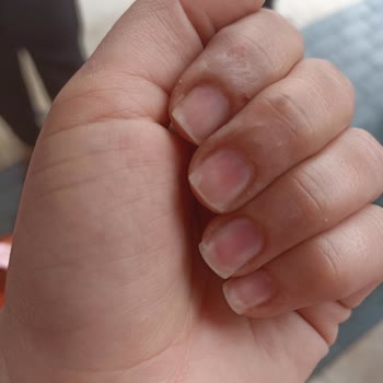 Markantalya Gratis Tırnak İşlemi