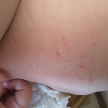 Sleepy Marka Bez Alerjik Sorun