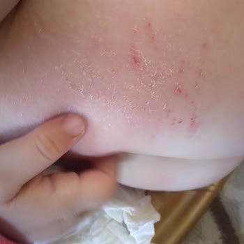 Sleepy Marka Bez Alerjik Sorun