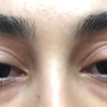 La Roche – Posay Lipikar Syndet Ap+ Cleansing Gel Irritated My Eyes