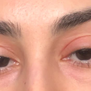 La Roche – Posay Lipikar Syndet Ap+ Cleansing Gel Irritated My Eyes