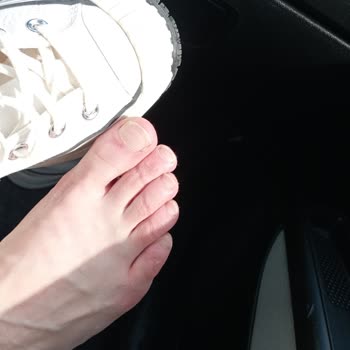 Converse Parmaklarımı Eziyor Topuklarım Yara Oldu