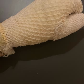 Porsi10 Gurme Cheddarlı Patates Topları'ndan Kaynaklı Yüz Ve El Yaralanması