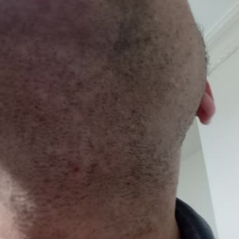 Goldmaster Oscar 7143 Tras Makinesi Sakal Kesmiyor