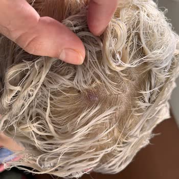 Palette Saç Derisi Su Toplama