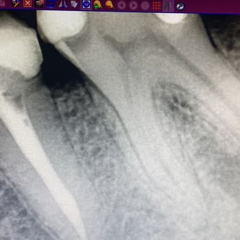 Dent Dream Klinik Sorun Yaşama