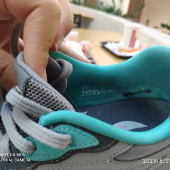 Sketchers Yeni Sezon Ayakkabım Yırtıldı Marka Arkasında Durmuyor