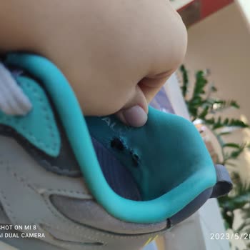 Sketchers Yeni Sezon Ayakkabım Yırtıldı Marka Arkasında Durmuyor