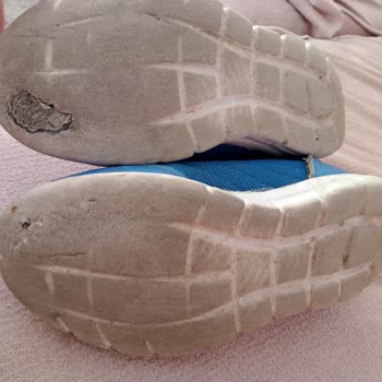 Hummel'dan Aldığım Spor Ayakkabısında Sorun Var