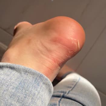 Elle'de Sneaker Mağduriyeti
