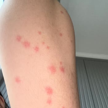 Grand Adanus Hotel Kötü Hizmet Sıfır Temizlik