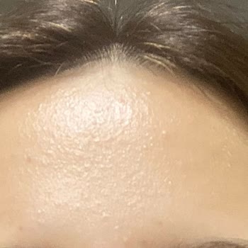 Nivea Yüz Yıkama Köpüğü Yüzümü Kızarttı!