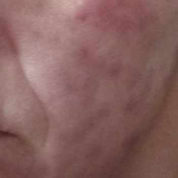 Elos Lazer Güzellik Ve Sağlık Memnuniyetsizlik