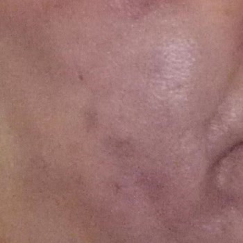 Elos Lazer Güzellik Ve Sağlık Memnuniyetsizlik