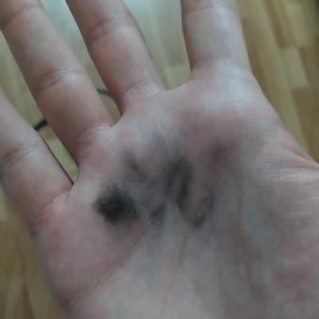 Monster Abra A5 Şarj Cihazı Elimde Patladı